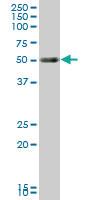 Anti-HNF1B Mouse Monoclonal Antibody [clone: 3H4]