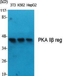 Western blot analysis of various cells using Anti-PKA-R2 beta Antibody