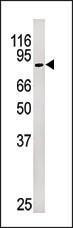 Anti-RB1 Rabbit Polyclonal Antibody (Biotin)