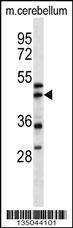 Anti-ACTR1A Rabbit Polyclonal Antibody (AP (Alkaline Phosphatase))