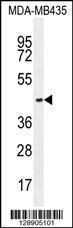 Anti-OR2L13 Rabbit Polyclonal Antibody (AP (Alkaline Phosphatase))