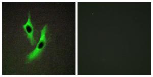 Immunofluorescence analysis of HeLa cells using Anti-STEAP4 Antibody. The right hand panel represents a negative control, where the antibody was pre-incubated with the immunising peptide