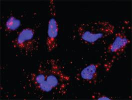 Anti-CDK4 + SMAD3 Antibody Pair