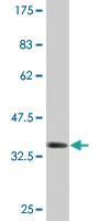 Anti-FOXM1 Mouse Monoclonal Antibody [clone: 4G3]