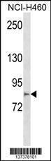 Anti-MCTP2 Rabbit Polyclonal Antibody (APC (Allophycocyanin))