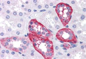 Anti-APH1A Antibody (A82710) (5 µg/ml) staining of paraffin embedded Human Kidney. Steamed antigen retrieval with citrate buffer pH 6, AP-staining