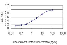 Anti-CTNNBIP1 Mouse Monoclonal Antibody [clone: 5C6]