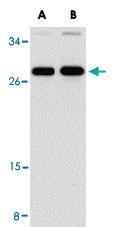 Anti-PPPDE1 Rabbit Polyclonal Antibody