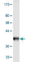 Anti-CAV3 Mouse Monoclonal Antibody [clone: 1B9]