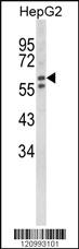 Anti-HEXA Rabbit Polyclonal Antibody