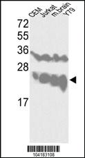 Anti-UCHL1 Rabbit Polyclonal Antibody