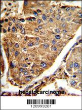 Anti-HEXA Rabbit Polyclonal Antibody