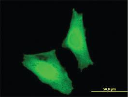 Anti-MAF Mouse Monoclonal Antibody [clone: 6B6]