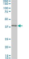 Anti-SPP1 Mouse Monoclonal Antibody [clone: 3E11]