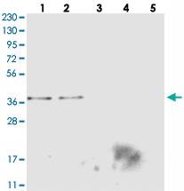 Anti-MTHFD2L Rabbit Polyclonal Antibody