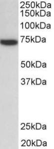 Anti-ZAP70 antibody