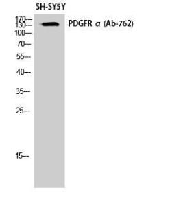 Anti-PDGFR alpha antibody