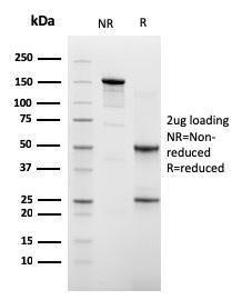 SDS-PAGE analysis of Anti-Cadherin 16 Antibody [CDH16/2448] under non-reduced and reduced conditions; showing intact IgG and intact heavy and light chains, respectively. SDS-PAGE analysis confirms the integrity and purity of the antibody