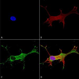 Immunocytochemistry/Immunofluorescence analysis of human neuroblastoma cells (SH-SY5Y), fixed in 4% PFA for 15 min, using Anti-Notch1 Antibody [S253-32] (A304795), at 1:50 for overnight at 4°C with slow rocking