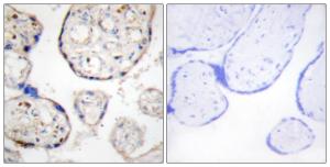 Immunohistochemical analysis of paraffin-embedded human placenta tissue using Anti-STEAP4 Antibody. The right hand panel represents a negative control, where the antibody was pre-incubated with the immunising peptide