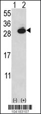 Anti-UCHL1 Rabbit Polyclonal Antibody