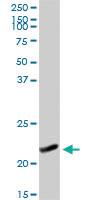 Anti-NDUFB10 Rabbit Polyclonal Antibody