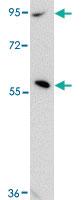 Anti-ZNF667 Rabbit Polyclonal Antibody