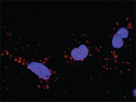 Anti-CRK + SOS1 Antibody Pair