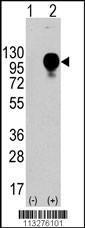 Anti-LAMP2 Rabbit Polyclonal Antibody (Biotin)