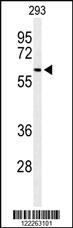 Anti-SNX27 Rabbit Polyclonal Antibody