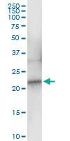 Anti-NDUFB10 Rabbit Polyclonal Antibody