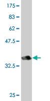 Anti-AATK Mouse Monoclonal Antibody [clone: 2C8]