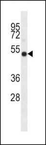 Anti-I23O2 Rabbit Polyclonal Antibody (PE (Phycoerythrin))