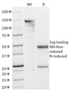 SDS-PAGE analysis of Anti-Galectin 13 Antibody [PP13/1161] under non-reduced and reduced conditions; showing intact IgG and intact heavy and light chains, respectively SDS-PAGE analysis confirms the integrity and purity of the antibody