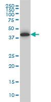 Anti-SPP1 Mouse Monoclonal Antibody [clone: 3E11]