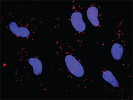 Anti-GSK3B + IKBKG Antibody Pair