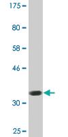 Anti-AATK Mouse Monoclonal Antibody [clone: 2C8]