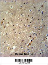 Anti-ACTL6B Rabbit Polyclonal Antibody (Biotin)