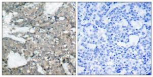 Anti-MEK1 + MEK2 Rabbit Polyclonal Antibody