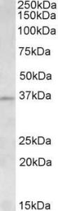 Anti-AURKC Antibody (A82713) (15 µg/ml) staining of Human Testis lysate (35 µg protein in RIPA buffer) Primary incubation was 1 hour Detected by chemiluminescence