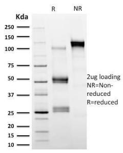 SDS-PAGE analysis of Anti-Calpastatin Antibody [CAST/1550] under non-reduced and reduced conditions; showing intact IgG and intact heavy and light chains, respectively. SDS-PAGE analysis confirms the integrity and purity of the Antibody