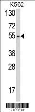 Anti-TH Rabbit Polyclonal Antibody