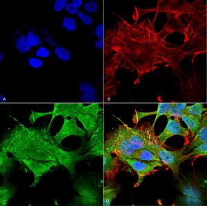 Immunocytochemistry/Immunofluorescence analysis of human neuroblastoma cell line (SK-N-BE, fixed in 4% formaldehyde for 15 min at room temperature, using Anti-Notch1 Antibody [S253-32] (A304795), at 1:100 for 60 minutes at room temperature