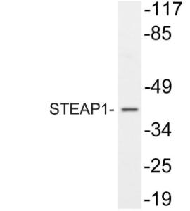 Western blot analysis of lysate from A549 using Anti-STEAP1 Antibody