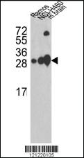 Anti-UCHL1 Rabbit Polyclonal Antibody