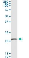 Anti-GUCA1C Antibody Pair