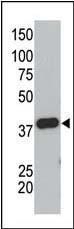 Anti-SUMO, Pan Rabbit Polyclonal Antibody (APC (Allophycocyanin))