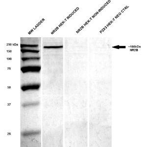 Anti-NMDAR2B antibody