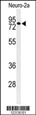 Anti-CIRH1A Rabbit Polyclonal Antibody