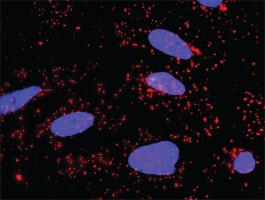 Anti-APPL1 + AKT1 Antibody Pair